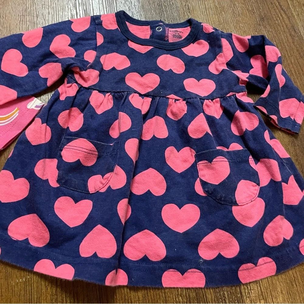 Two Dresses - Picture 3 of 5